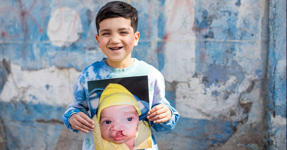 Joaquín con una foto suya de bebé, antes de la operación de FLAP.
