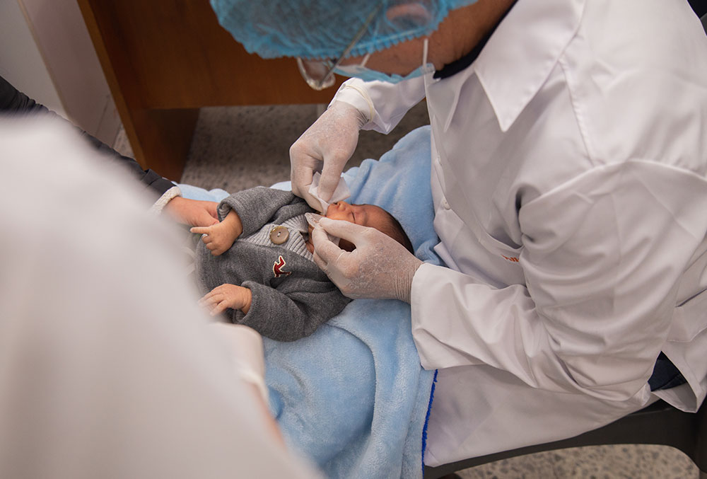 baby with a cleft gets an impression of their mouth made at FISULAB