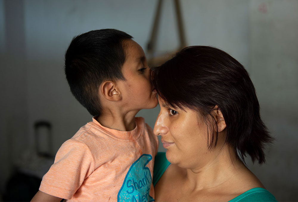 Anghelo besa a su madre después de una cirugía de paladar hendido