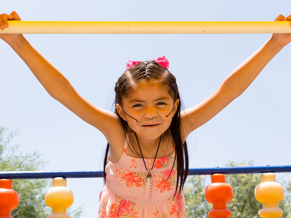 Barbara after cleft surgery hanging from a bar at the playground