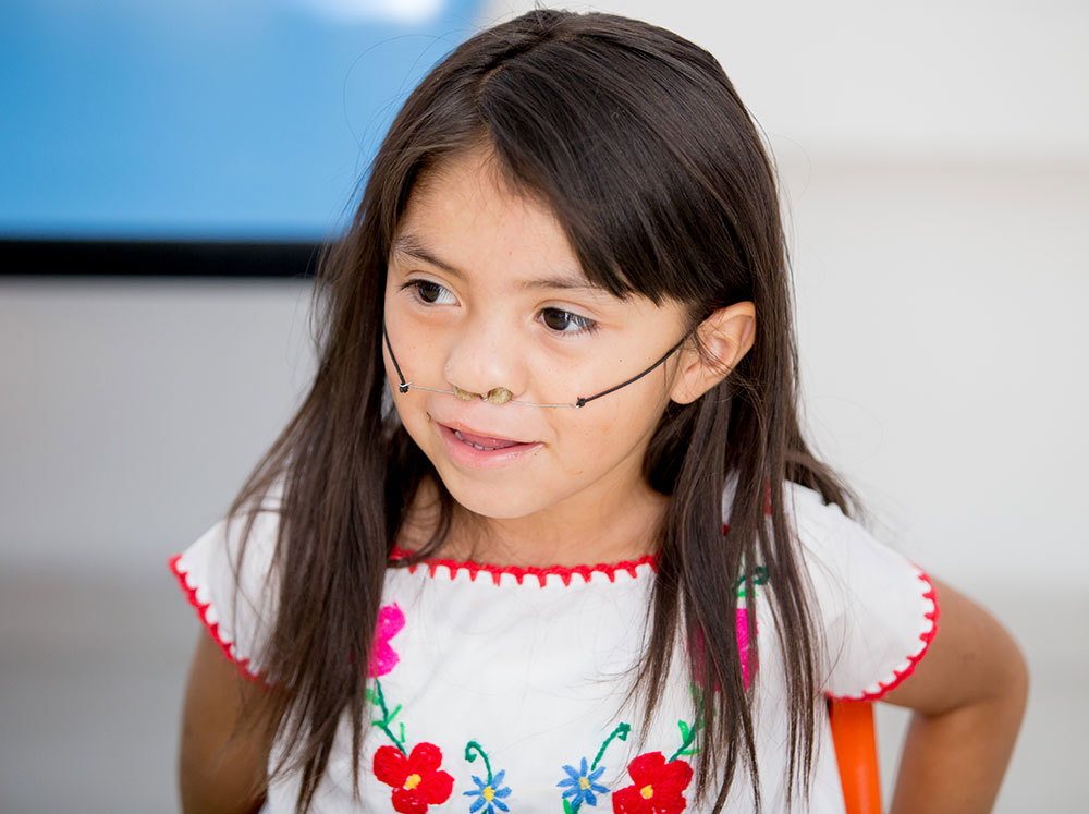 Barbara after cleft surgery with a device to help her speak and breathe