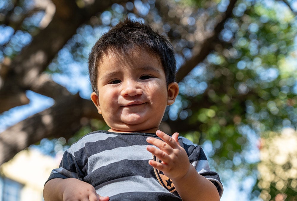 Felix smiling after cleft surgery