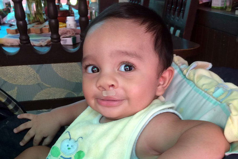 Hector Daniel smiling after cleft surgery