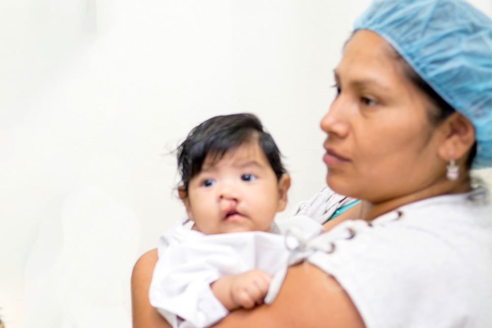 Luz holds Mia before her cleft surgery