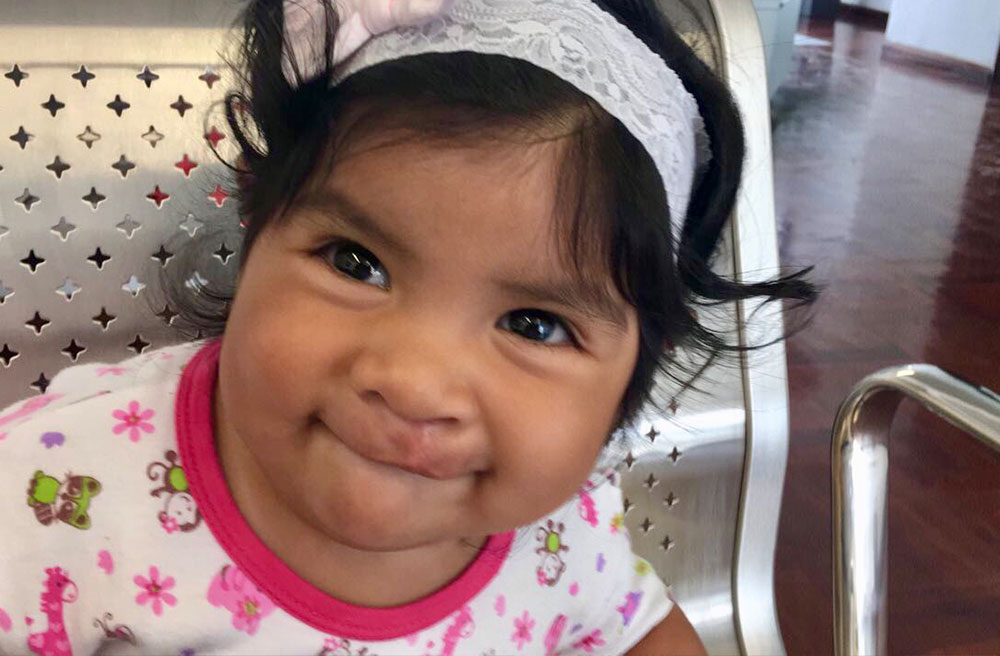 Mia smiling after cleft surgery