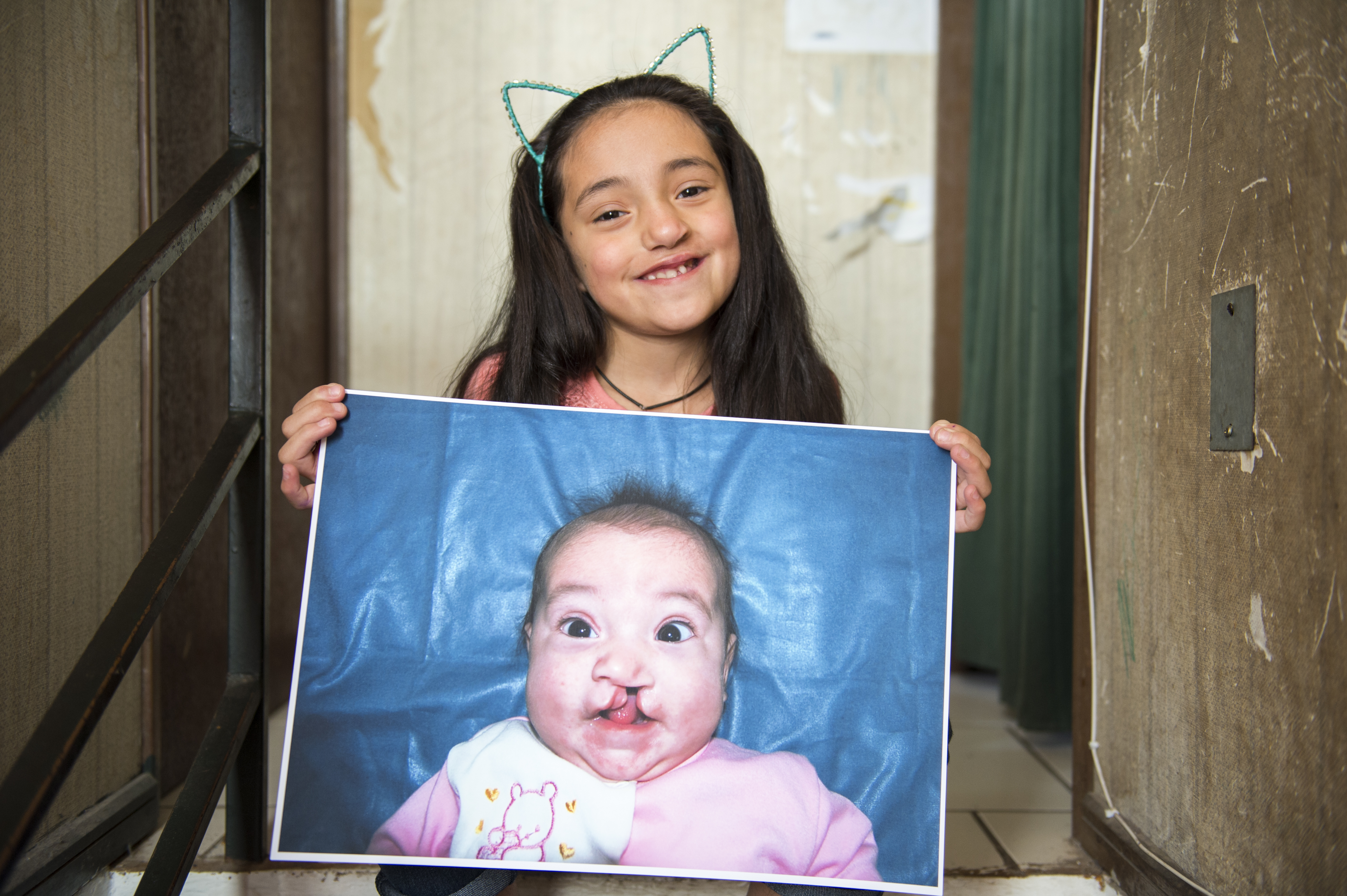 Camila holding a picture of herself before cleft surgery