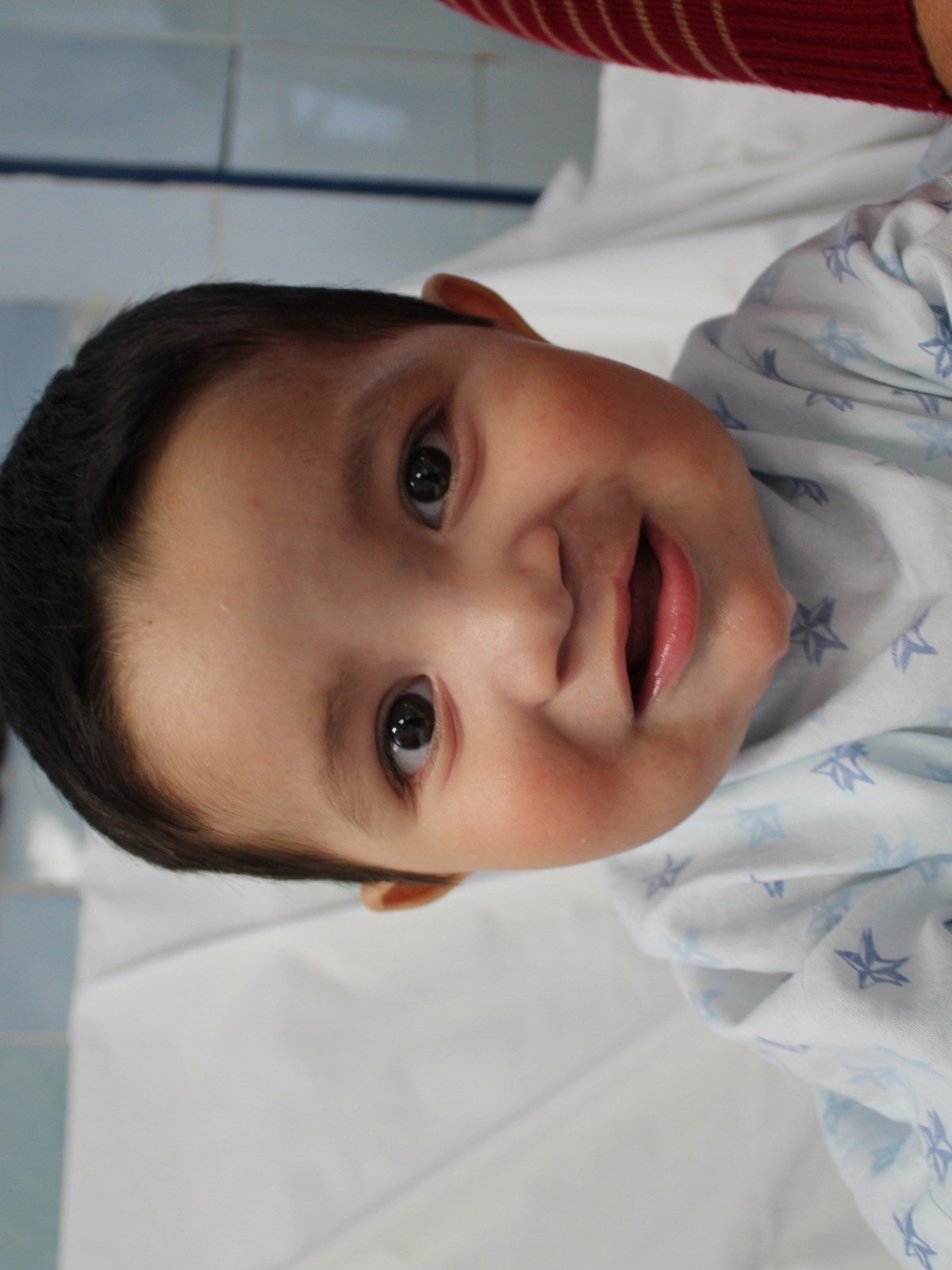 Gael smiling after cleft surgery