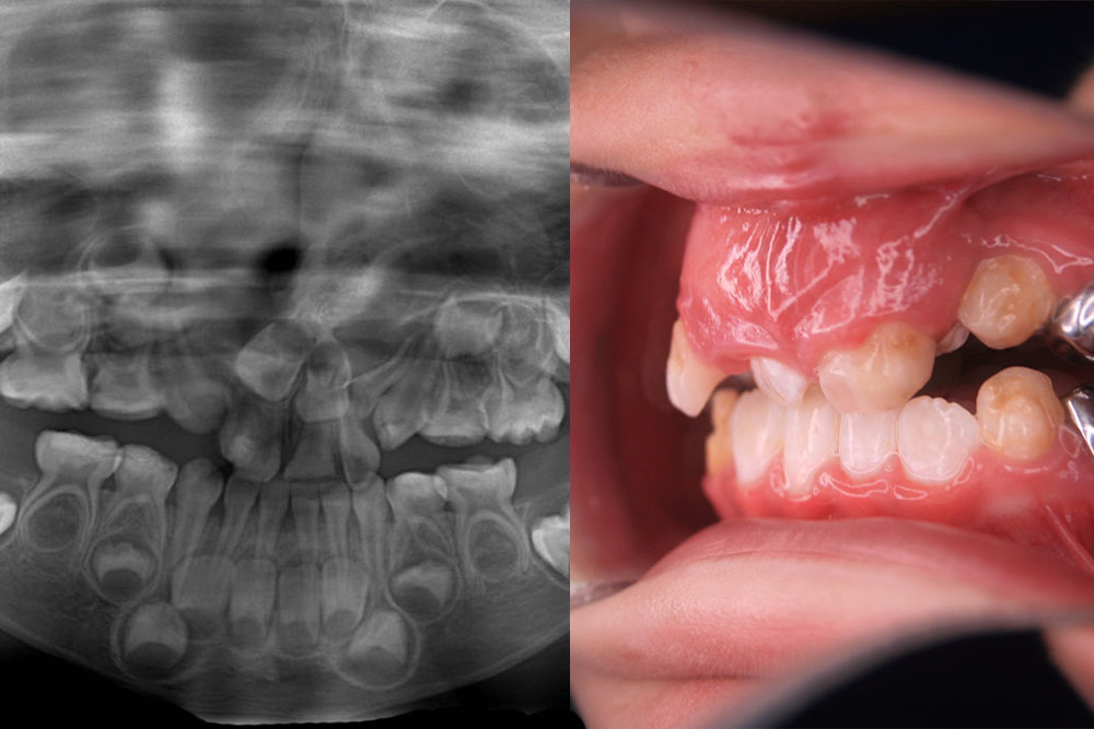 Neitan's orthodontic images
