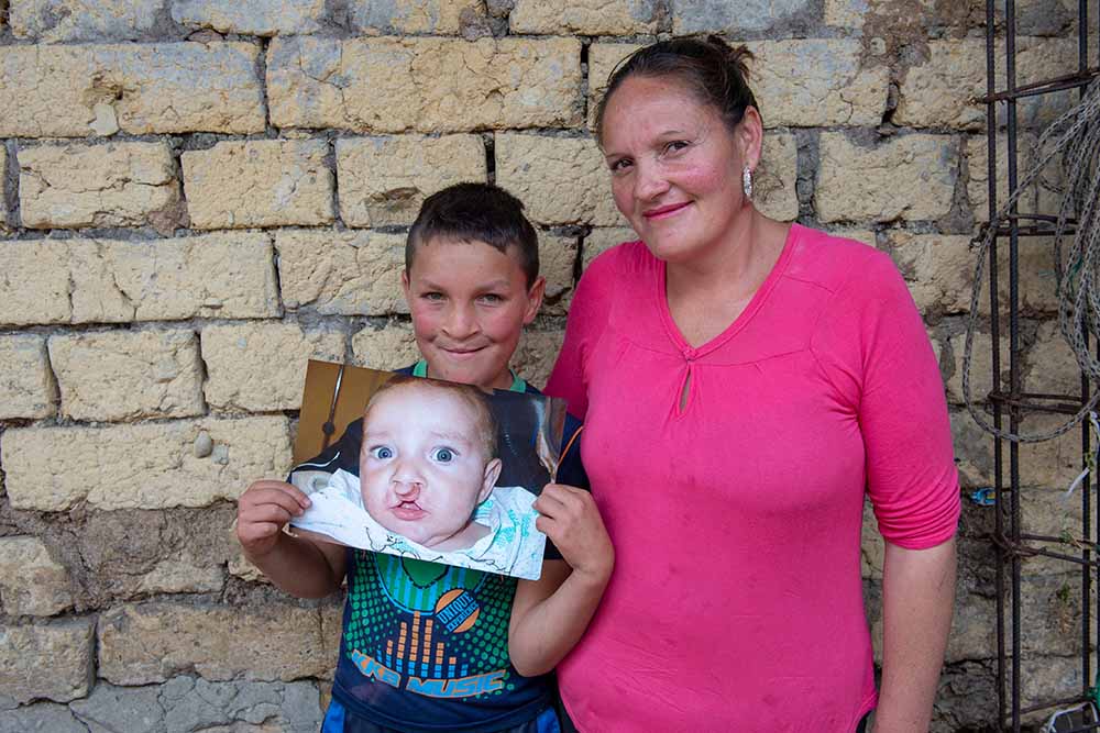 Neitan smiling with his mom holding a picture of himself before cleft surgery
