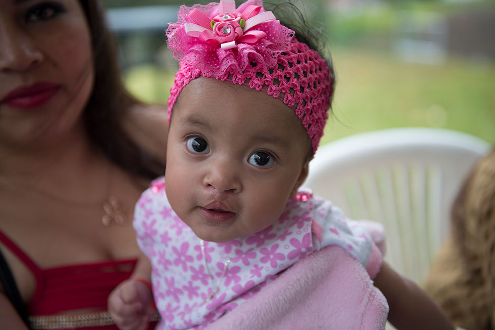 A patient with a pink bow after cleft surgery
