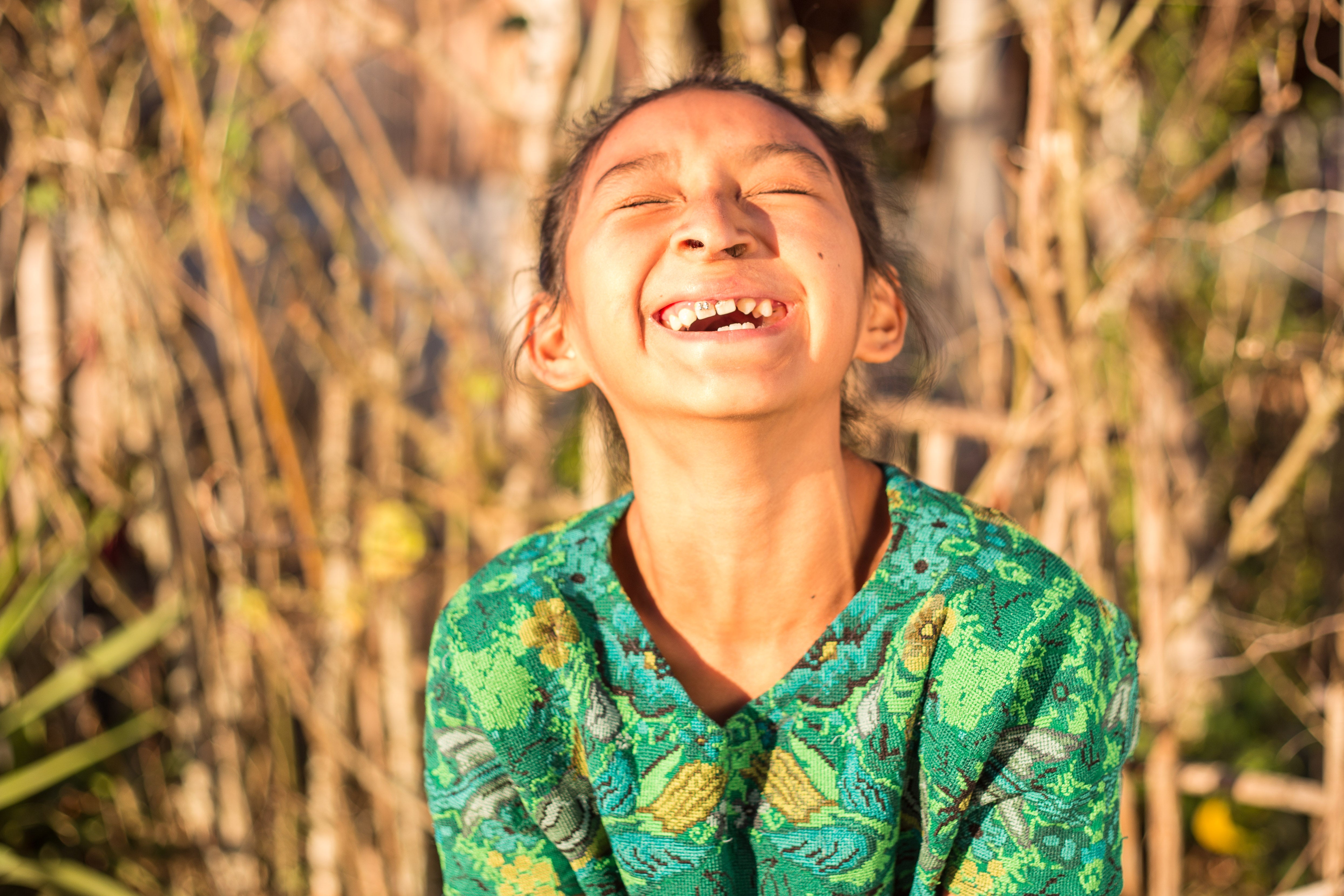 Valery laughing after cleft surgery