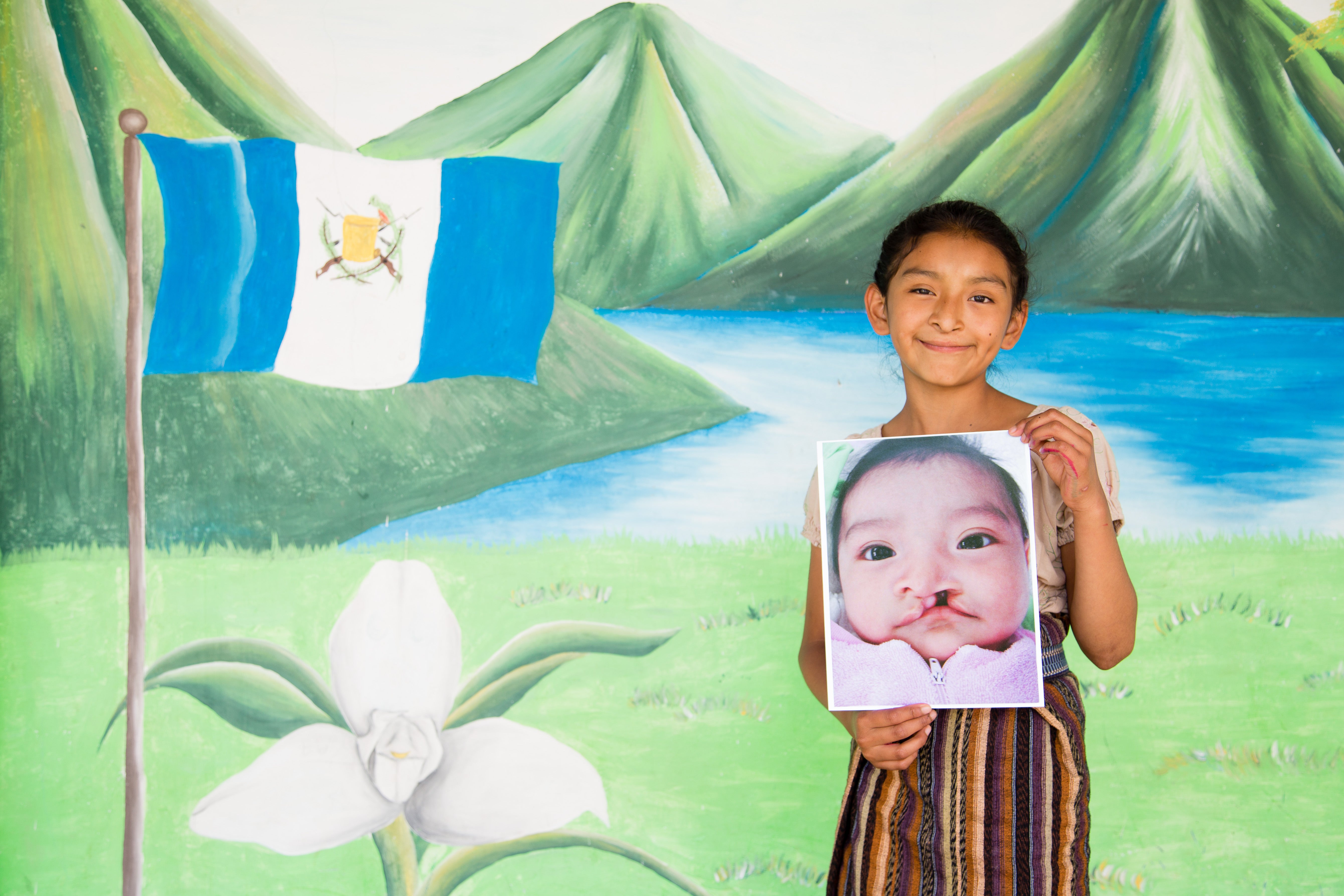 Valery sonriendo y sosteniendo una foto de ella misma antes de la cirugía de fisura