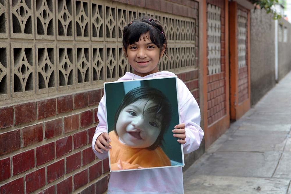 Bhania with a photo of herself from before cleft treatment