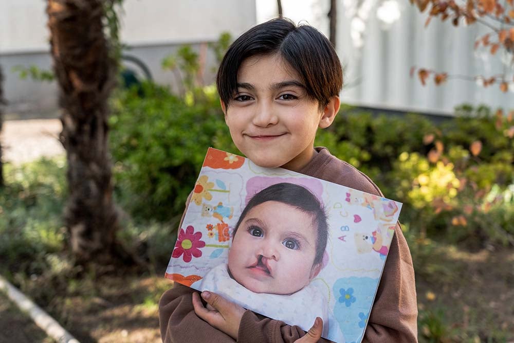 Tomas smiles while holding up a photo of himself as a baby, from before he received cleft treatment