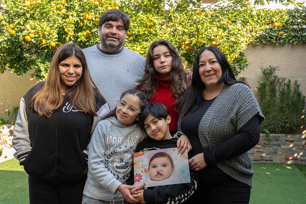 Tomas’ family gathers for a photo together, including his parents and his three sisters. He holds up a baby photo of himself from before cleft treatment