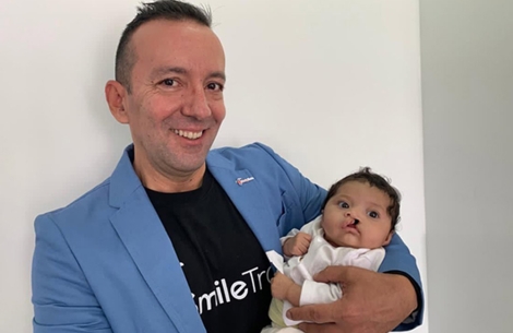 Ivan Velez holding a cleft affected baby
