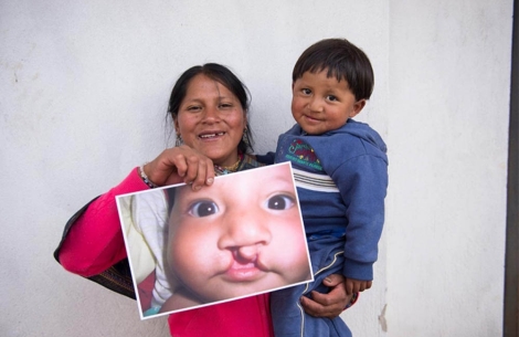 Magaly holding David and a picture of him before cleft surgery