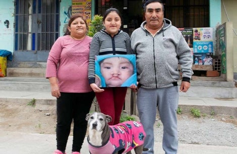 Chiara and her family holding a picture of her before cleft surgery