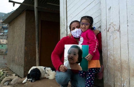 Kristhell and her mother Cinthya holding a picture of her before cleft surgery