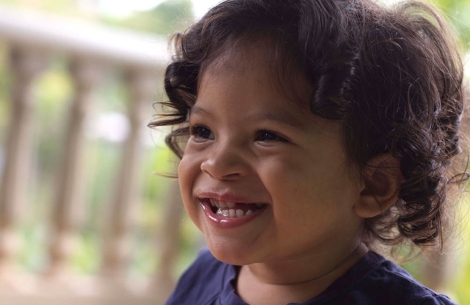 Marco smiling after cleft surgery