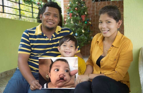 Elifeleth smiling with his parents and holding a photo of himself before cleft surgery