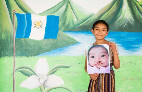 Valery smiling and holding a picture of herself before cleft surgery