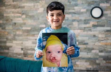 Joaquín sonríe y sostiene una foto suya antes de la operación de fisura labio palatina.