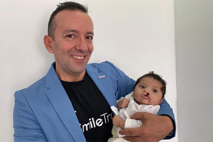 Ivan Velez sostiene a un bebe afectado de fisura