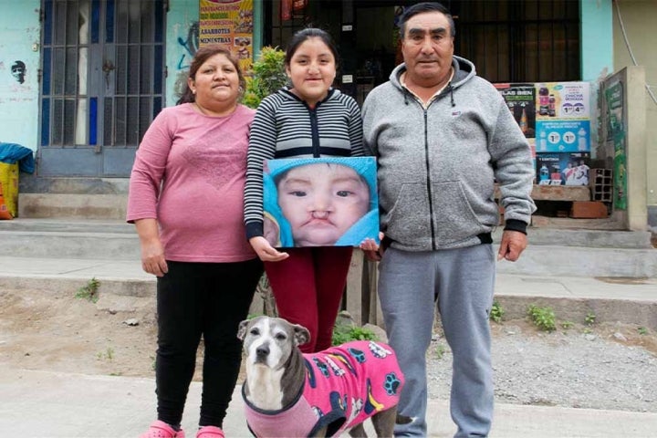 Chiara and her family holding a picture of her before cleft surgery