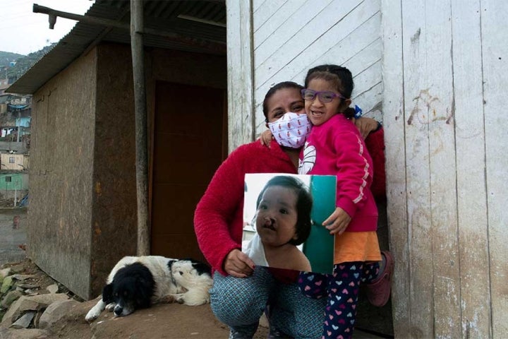 Kristhell and her mother Cinthya holding a picture of her before cleft surgery