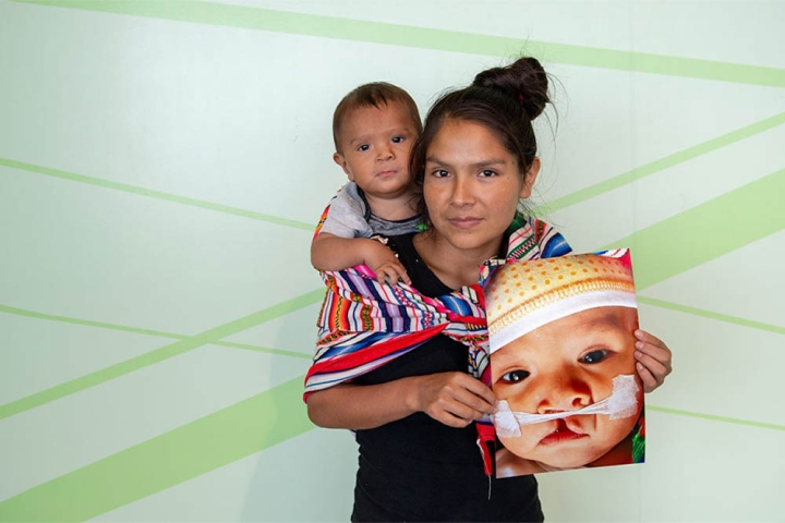 Zindia sostiene a su hijo joseyur y una foto de el antes de la cirugia de paladar hendido