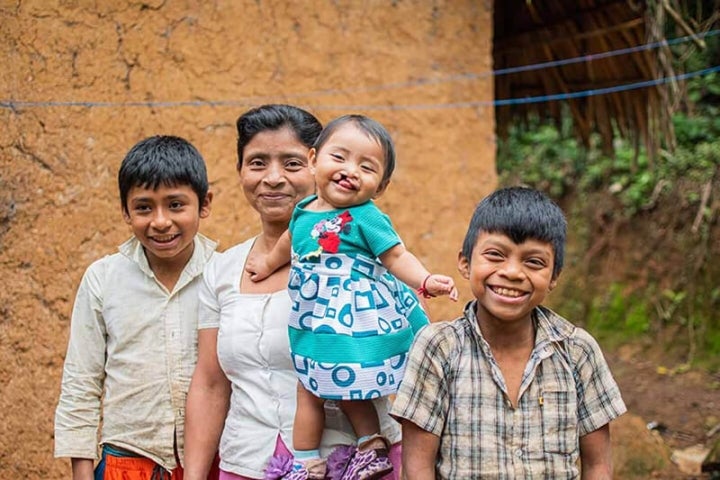 Una madre sonríe con sus hijos y su hija con fisura labio palatina antes de ser operados.