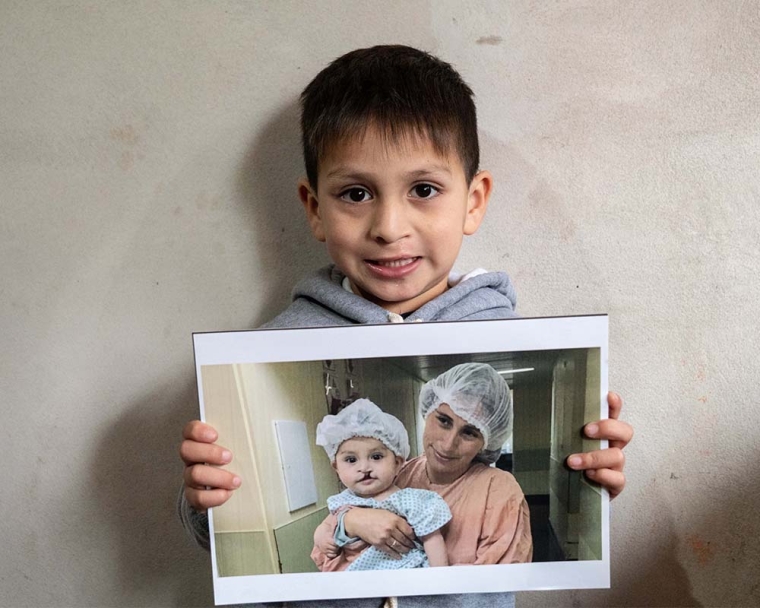 Boy hold image of himself before cleft lip surgery