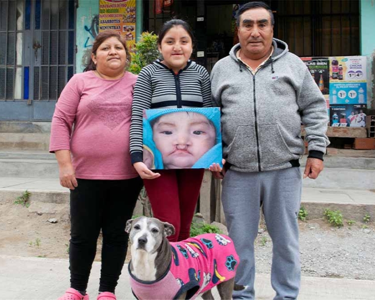 Chiara and her family holding a picture of her before cleft surgery