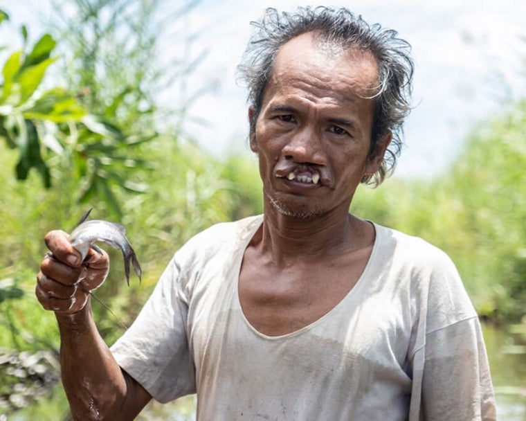 Alim pescando antes de la operación