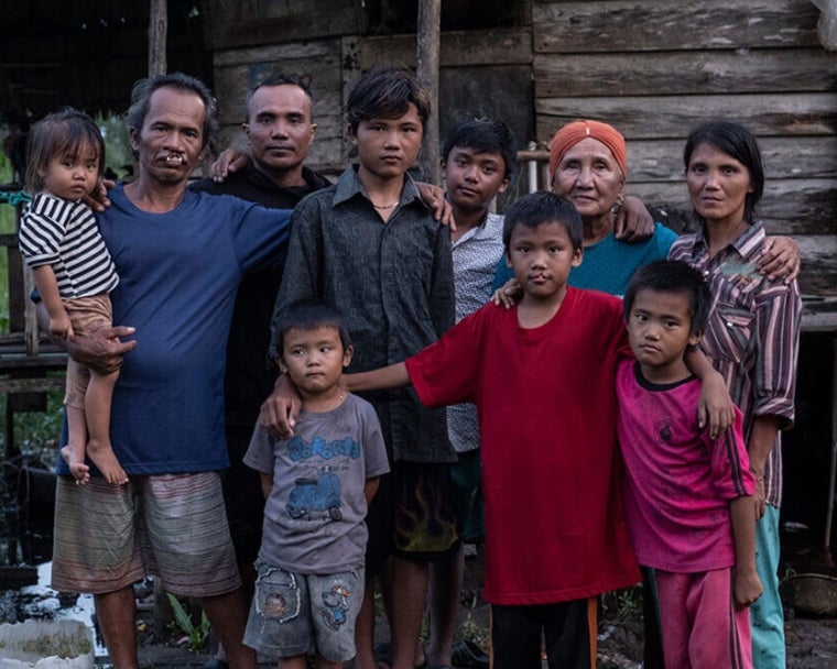 Alim y Rajib sonriendo con su familia antes de la cirugía de fisura labio palatina